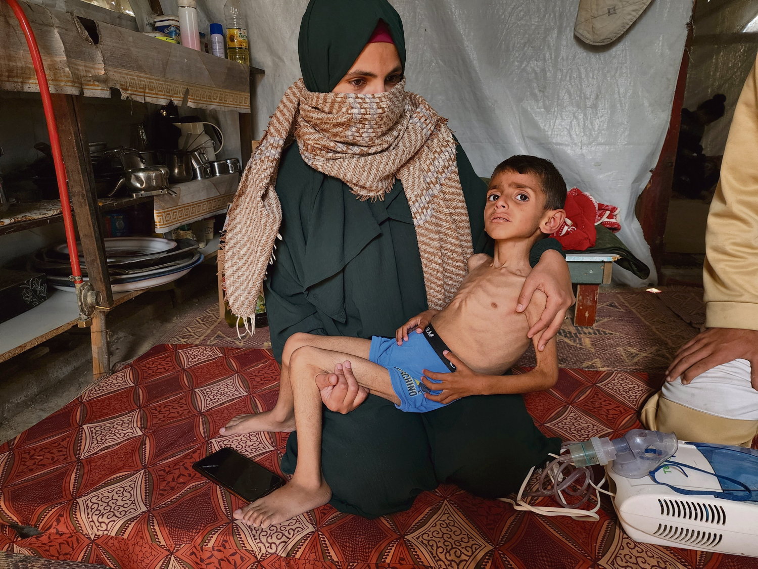 Famine en Gaza : l’ONU dénonce une tragédie orchestrée par Israël